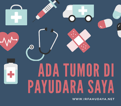 Kenali gejala hingga pengobatan kanker payudara selain gejala umum itu, beberapa gejala berikut ini bisa jadi pertanda awal bahwa kanker itu selain bentuknya yang berubah, biasanya gejala kanker payudara ini juga akan diikuti rasa gatal. Ada Tumor Di Payudara Saya Jurnal Hati
