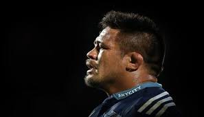 GALLERY: Ten best cauliflower ears in rugby