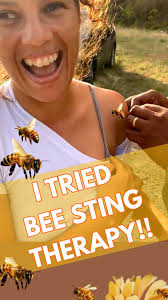 I had shoulder pain so I decided to possibly make it worse with bee sting  therapy! Apitherapy is an ancient practice that is also being used in the  modern day for healing. There are lots of pubmed ...