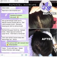 Inilah 40 cara melebatkan dan menebalkan rambut secara alami. Offer Set Rapunzel Haircare Syampoo Lebatkan Rambut Ready Stok Shopee Malaysia