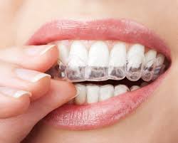 Dentist recommended · 55 years of innovation · clinically proven How Invisalign Changes Your Face