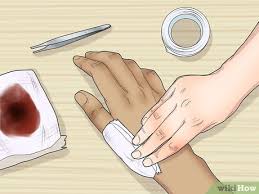 While some people are big believers in triple antibiotic ointments, others feel they are less than necessary. How To Apply Neosporin 11 Steps With Pictures Wikihow