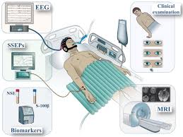 therapeutic hypothermia ...