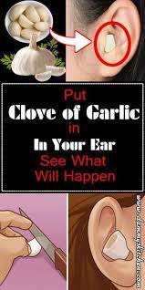 Pin On Home Remedies