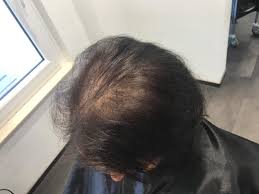 Über 5.000 verschiedene perücken und haarteile flexible und sichere zahlung kostenfreier versand in deutschland ab 50 €uro bestellwert. Gl Volume Eine Haarverdichtung Die Neue Massstabe Setzt Friseur Magdeburg