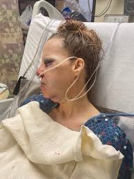 Fundraiser by Amanda Ferrell : Support for Jackie Peak After Accident