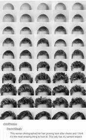 Hair Growing After Chemo Hair Growth After Chemo Hair Story Chemo Hair