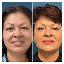 Cirujano Plástico Mexicali