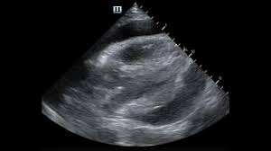 Image result for FAST Exam