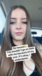 Dating as a Single Woman with a Scar