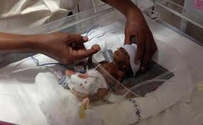 Skema sertifikasi operator komputer junior. This Preemie Weighed As Much As A Cellphone Then A Hospital Worked Its Magic Everylifecounts Ndtv Com