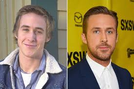 15 Male Celebs You Didn T Know Had Plastic Surgery Photos