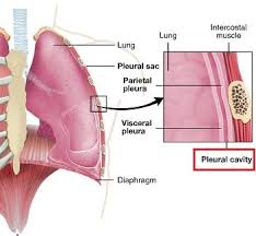 Image result for Thoracentesis
