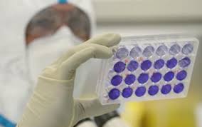 The news of the fire goes beyond national borders, and i too become a sort of representative of my land of sardinia, to which closeness is expressed in these. Coronavirus 22 I Nuovi Casi Registrati In Sardegna Nelle Ultime 24 Ore News Sardegnalive