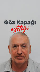 🇹🇷, Yaşlanma, yorgunluk ya da genetik faktörler nedeniyle göz  kapaklarınızda sarkma, torbalanma veya kırışıklıklar mı oluştu?, ✨Göz  Kapağı Estetiği bu sorunlara hem fonksiyonel hem de kozmetik bir ...