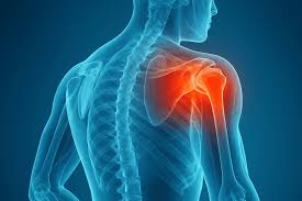 Image result for Shoulder Pain