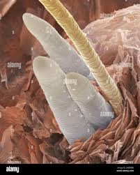 Image result for Demodex folliculorum