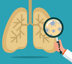 Image result for Tuberculosis