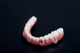Plus, one day dentures and immediate dentures are two different things altogether. How To Make Your Dentures In Sarasota Fit Better Than Ever