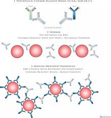 Image result for Direct Coombs