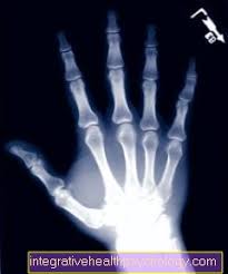 Silakan masuk dengan nama pengguna atau surel untuk melanjutkan. Jari Patah Ortopedik Online