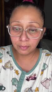 cómo quitar las verrugas sin cirugía en solamente 3 pasos!! #fyp #para...