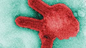 Guinea health officials have confirmed west africa's first case of marburg, a highly infectious disease in the same. Marburg Virus Disease Guinea Confirms West Africa S First Case Of Rare Ebola Like Disease Cnn
