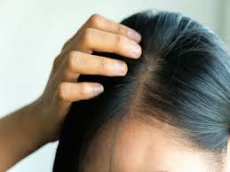 To use vitamin c to remove hair dye, you can try mixing a cup 1/2 of. Grey Hair Home Remedies How To Get Rid Of Grey Hair Naturally