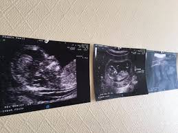 Spécialisée en echographie à domicile, notre unité médicale mobile se déplace à votre domicile à paris ou en banlieue parisienne pour. Dr Jean Claude Franco Gynecologue Medical Et Obstetrique A Paris