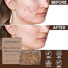 Amazon.com : HERBOGANIC Raw African Black Soap Bar