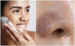 Skrub pula, cara untuk kita buang kulit mati tu. Jangan Picit Dah Ini 5 Cara Mudah Hilangkan Blackhead Whitehead Dari Kulit Muka Buzzkini