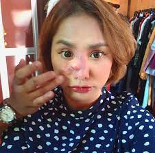 Definisi/arti kata 'hidung' di kamus besar bahasa indonesia (kbbi) adalah n 1 alat pencium, penghirup, penghidu (letaknya di sebelah ber·hi·dung v mempunyai hidung: Hidung Elly Mazlein Dapat Ketumbuhan Iluminasi