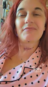 Well I survived Spinal surgery. Thanks for all your well wishes.