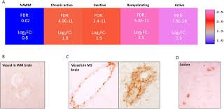 Global atlas on cardiovascular disease prevention and control. Ms Atlas A Molecular Map Of Brain Lesion Stages In Progressive Multiple Sclerosis Biorxiv