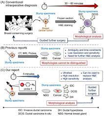 There can be other areas but this is good news. Scientists Develop System To Rapidly And Accurately Detect Tumor Margins During Breast Cancer Surgery