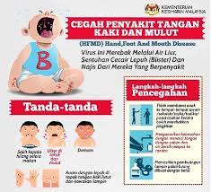Debunking The Myths Surrounding The Hand Foot And Mouth Disease Hfmd Lifestyle Rojak Daily