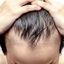 Effects on weight loss, insulin resistance, and cardiovascular risk: Keto Hair Loss Worldhealth Net Anti Aging News