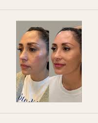 Rachel Codd DNP, AGACNP-BC