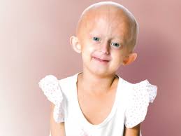 Learn vocabulary, terms and more with flashcards, games and other study tools. Explaining Accelerated Aging Center For Cancer Research National Cancer Institute