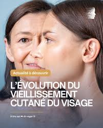 👨‍⚕️ La lampe flash (IPL) se présente de plus en plus comme un traitement  incontournable en dermatologie et médecine esthétique. Son usage, peu  encadré en centre esthétique par les esthéticiennes, a soulevé