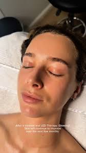 Éclaircissement après traitement de peau, nettoyage et thérapie LED.