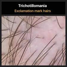 Check spelling or type a new query. Exclamation Mark Hairs Are Short Hairs That Are Commonly S Flickr