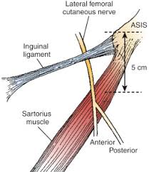 A statement from benitez read: Lower Extremity Lateral Femoral Cutaneous Nerve Block Musculoskeletal Key