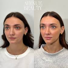 We pay so much attention to our faces.. but neglect your hands! As we age  the skin