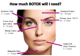 Image Result For Botox Injection Sites Chart In 2019 Botox