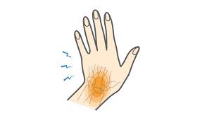 Image result for Scaphoid Fracture Signs