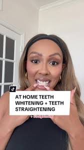 How to Straighten Teeth Naturally at Home