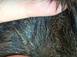 Some of the possible causes can include White Specks Dandruff Eggs Or Something Else Rats