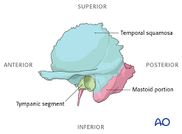 Image result for Temporal Bone
