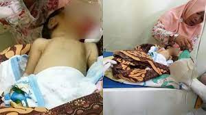 Wasir mungkin sudah keluar dari posisi dan menyebabkan prolap. Kisah Bayi 10 Hari Diberi Makan Pisang Malah Keluar Darah Dari Dubur Viral Orangtua Harus Waspada Tribun Wow
